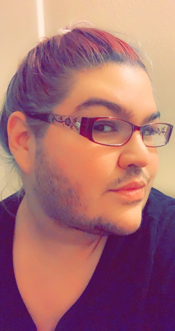 I Shave my beards daily for 16yrs to avoid being Bullied- Woman with beards spills (Photos)