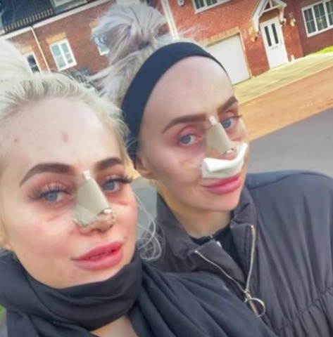 We Spent £140k to look alike- Sisters undergoes Procedure to Twin 
