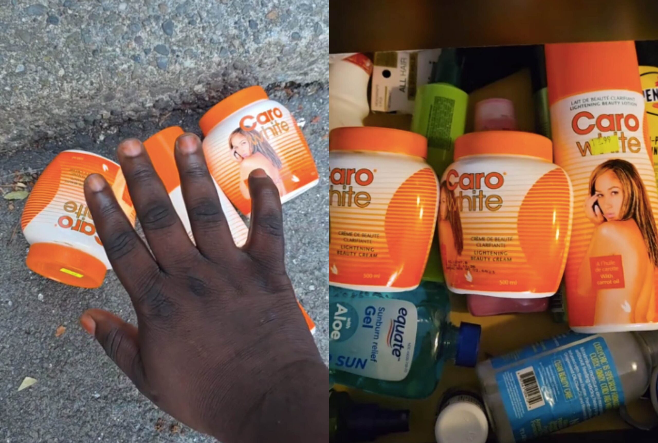 My Knuckles Are Too Black, I Am Done With Bleaching Creams – Man Cries Out, Shows His Knuckles As He Throws Away His Cream