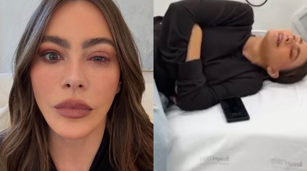 Sofía Vergara Misses Emmy Awards After Suffering Severe Eye Allergy