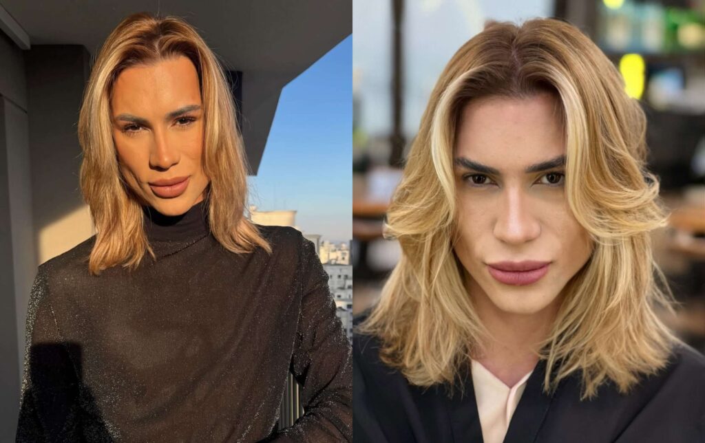 Popular Brazilian Influencer Junior Dutra Dies After Failed Botched Cosmetic Surgery