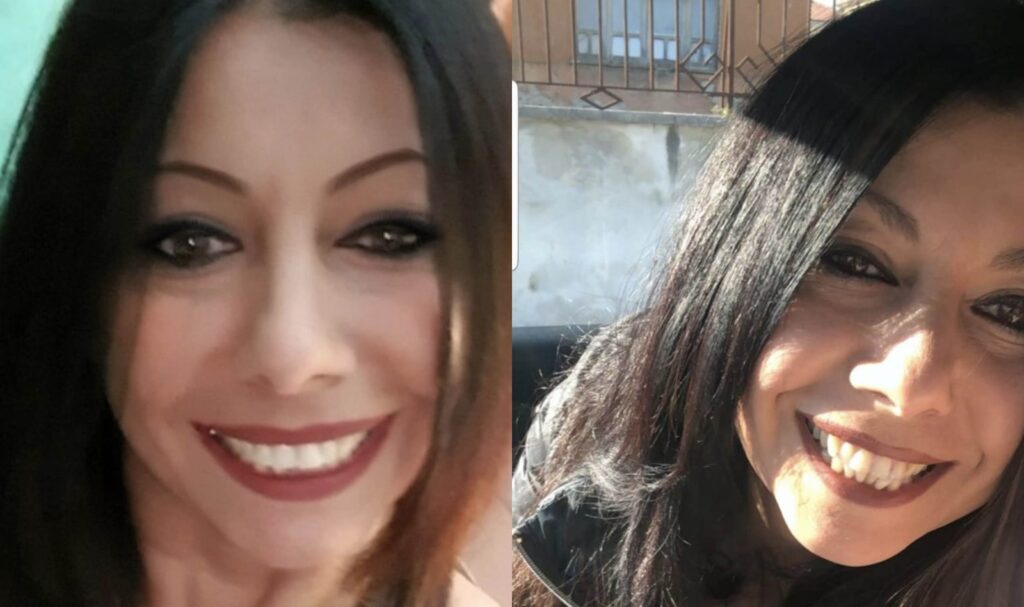 Woman Dies After Liposuction Surgery In Turkey
