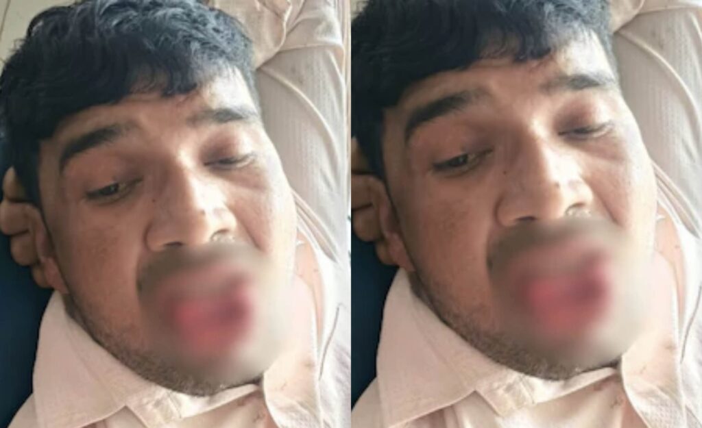 20-Year-Old Woman Bites Off Ex-Lover Tongue After He Tried to Forcefully Kiss Her