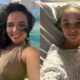 Actress Charlotte Chilton Diagnosed with Trigeminal Neuralgia, Set for Brain Surgery