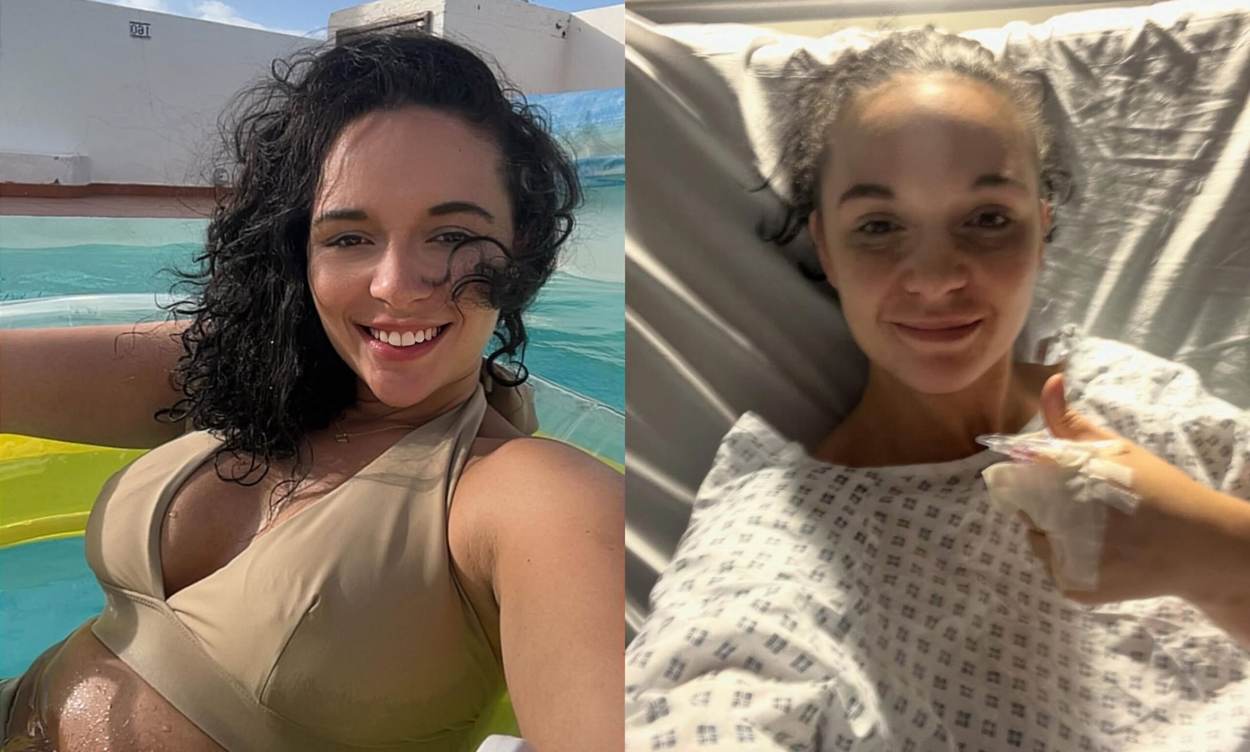 Actress Charlotte Chilton Diagnosed with Trigeminal Neuralgia, Set for Brain Surgery