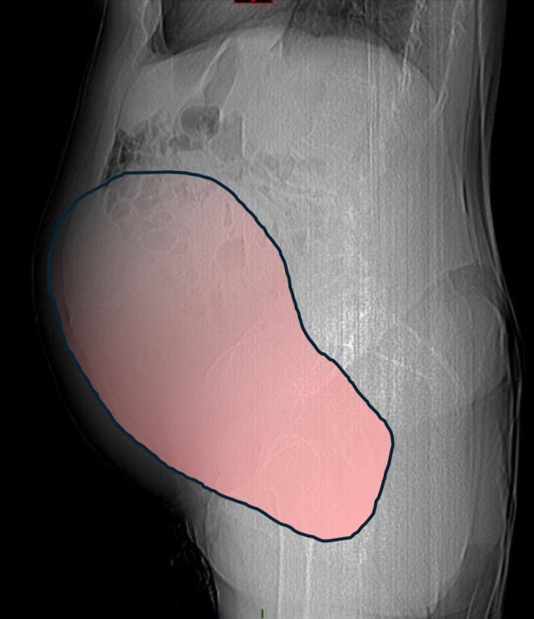 7ea99439 a3fa 45a1 b11b f7900c1a883b