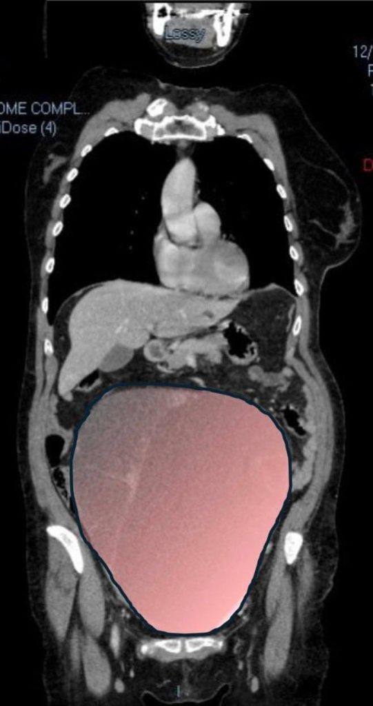 904c35f6 194c 4488 a3ce 662d1697bad1