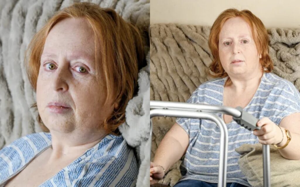 Woman Cries Out, Set to Sue NHS After Being Kept on Chemotherapy for 6 Years and Half Years