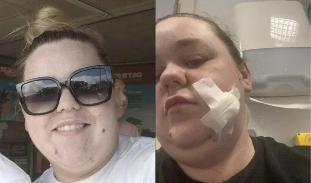 I trusted a tanning salon — now I’m battling stage 3 cancer