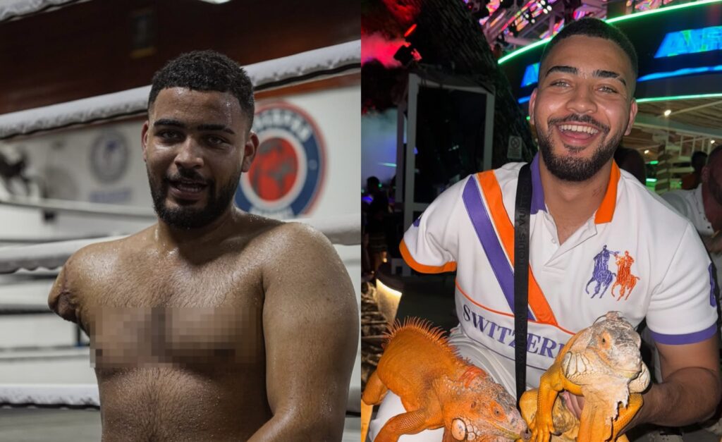 Influencer Justin Bunyai Finally Opens Up About Losing His Arm Last Year