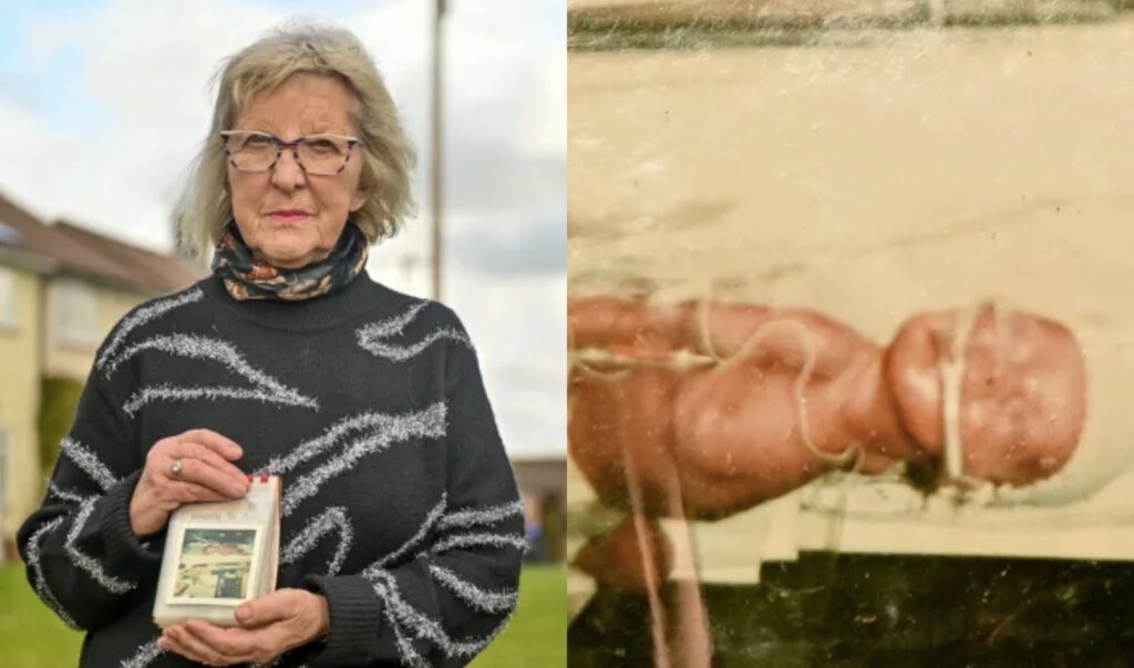 81-Year-Old Woman Reveals She Buried Her Baby Without Knowing His Br@in Had Been Removed, Blames Hospital