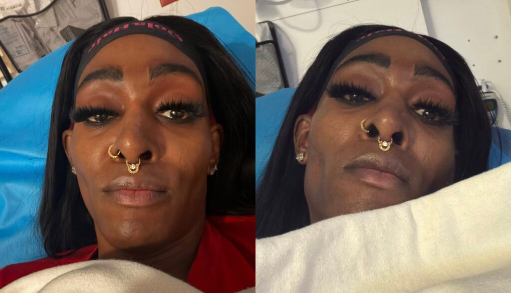 I knew this guy for three years— Woman Hospitalised, Shares her experience as her partner tries to m£rd£r her