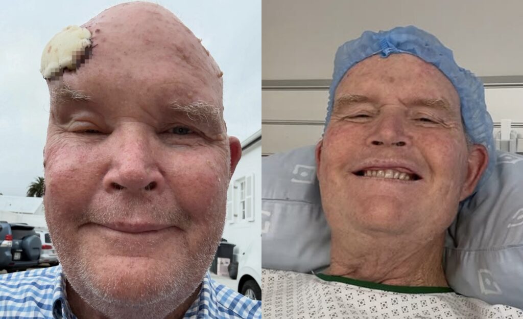 Man survives Cancer after doctors gave him just 6 months to live