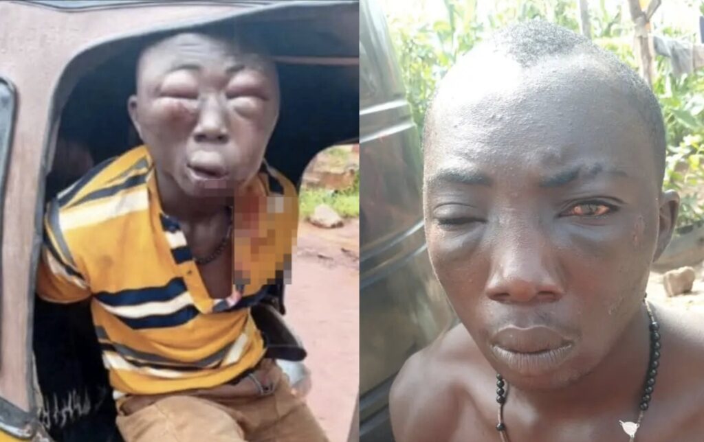 Man Wrongfully Accused of Stealing ₦2 Million Seen in New Photos After Assault