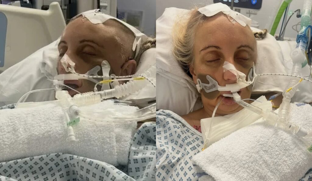 Mum Left Paralysed After Pregnancy Complications Lead to a Heart Tear and Blood Clot in Her Brain